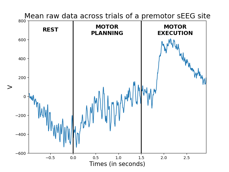 ../../_images/sphx_glr_plot_real_data_001.png